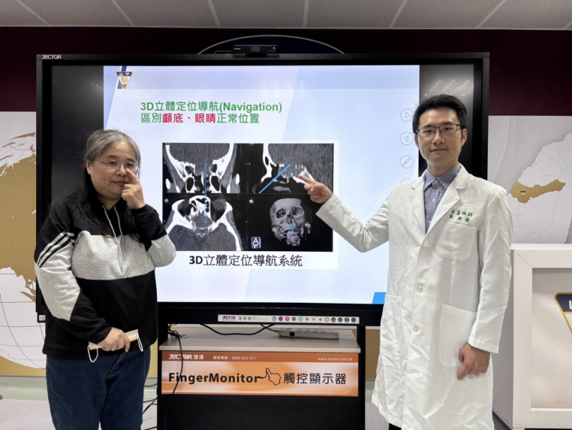 單側頭痛眼睛痛竟是鼻竇腫瘤造成 3D鼻竇定位導航系統手術精準除病灶