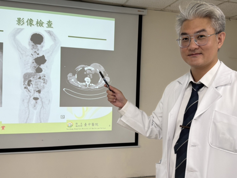 70歲企業主胸口長出14公分腫瘤 標靶化療後腫瘤幾乎消失