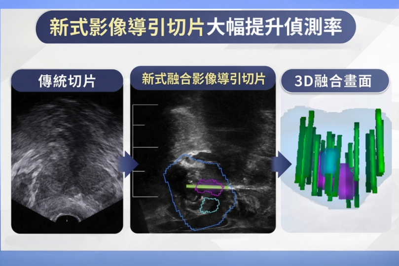 兩名7旬老農，經彰基以新式「攝護腺切片影像導引融合系統」檢查而早期發現攝護腺癌。（照片彰基提供）