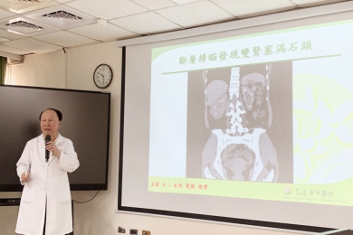 一女子2年5度腎結石  竟是罹患副甲狀腺亢進