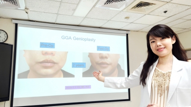 睡眠軟組織合併頦舌肌前置下巴整形手術 讓打火英雄好睡又變帥