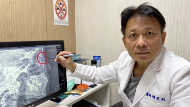 2歲兒子衝斷媽媽鼻骨(圓圈處),員榮醫院整型外科手術復原。(照片員榮提供)