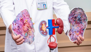 「多囊腎」導致腎功能惡化,陳老師雙側腎臟腫大至正常人的20倍。(照片彰基提供)