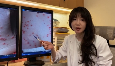 濕疹與毛囊炎難分辨　醫師提醒勿自行擦類固醇