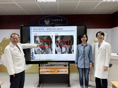 壓力引發顳顎關節疼痛　中山附醫跨專業治療助患者重拾生活品質