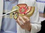 攝護腺肥大、排尿障礙，「攝護腺水蒸氣消融手術」（紅色圓圈）解危。（照片秀傳提供）